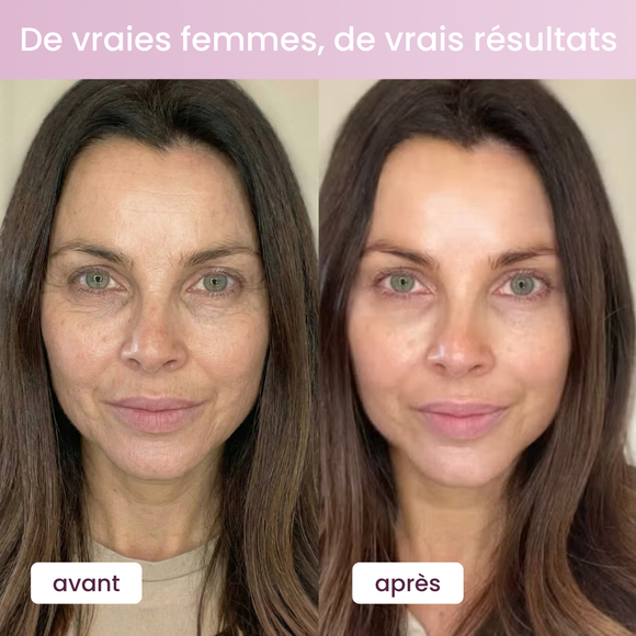 Feature product image