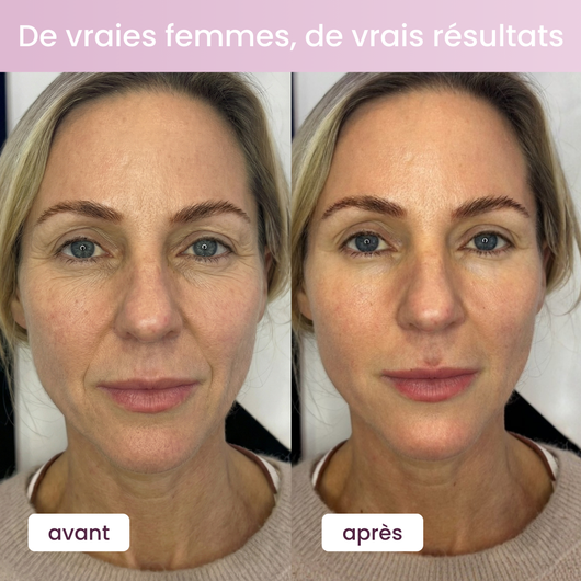 Premium Collagen with Vitamin C