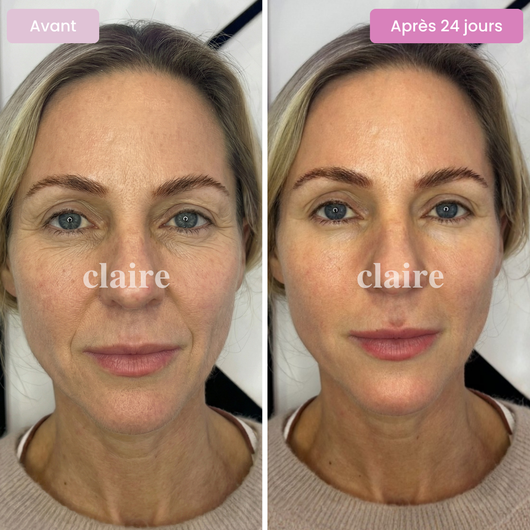 Multi Collagène Mix - Soutien de la peau et bien-être au quotidien