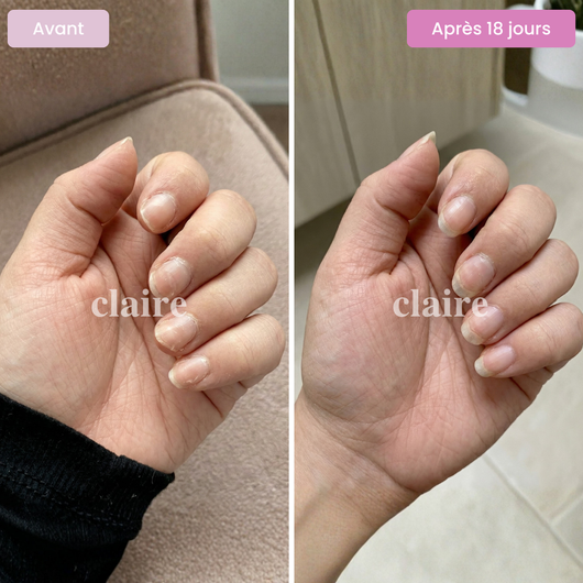 Multi Collagène Mix - Soutien de la peau et bien-être au quotidien